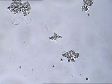 3月IgAテスト キットのIgAの抗体のコーティングの精子は精液機能テスト キットを傷つける
